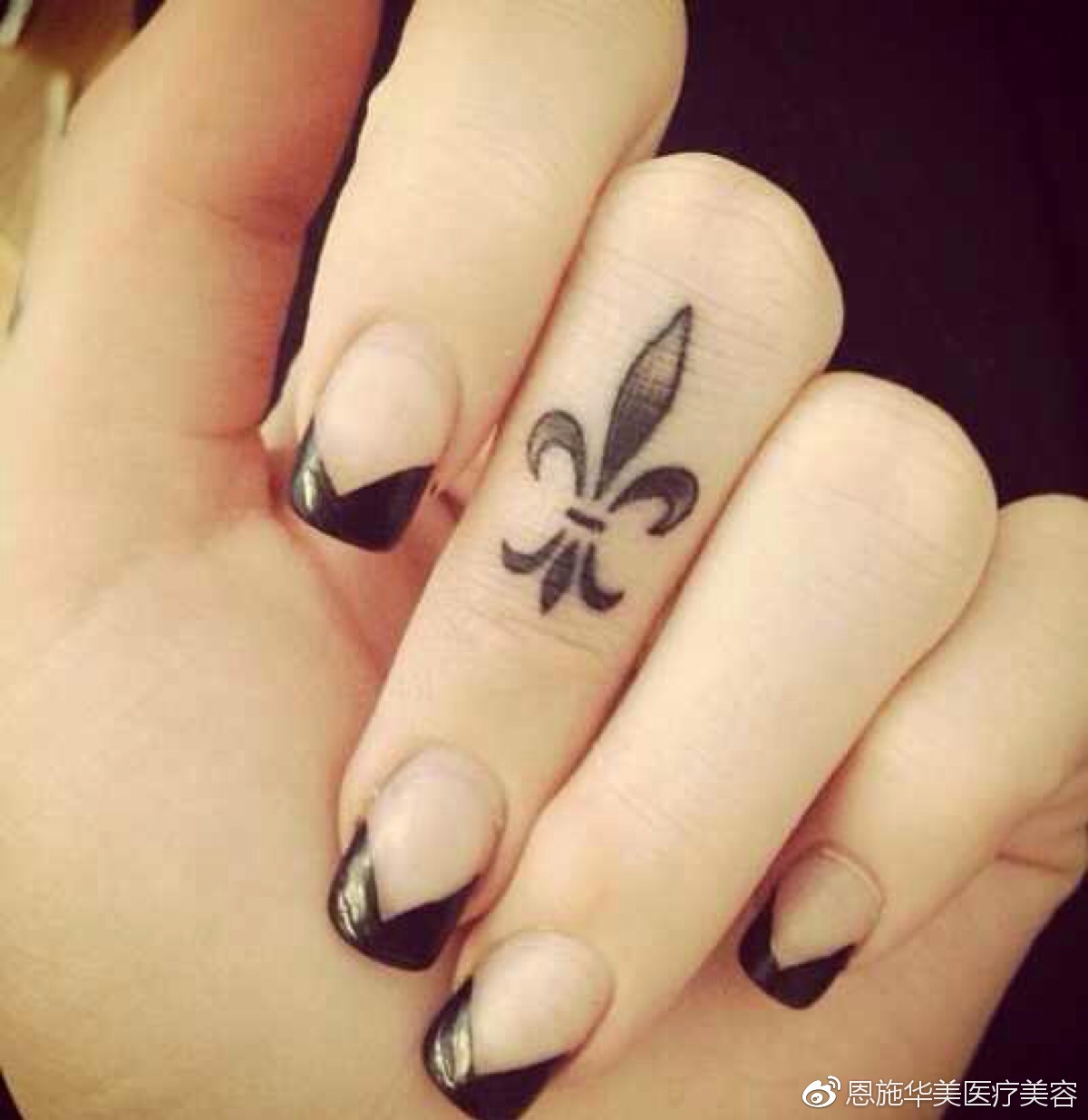 纹身洗掉留下疤怎么办,镭射能洗掉纹身和疤吗