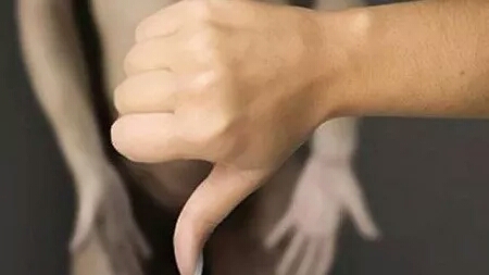 男性内分泌失调不育怎么治,男性内分泌异常有哪些症状