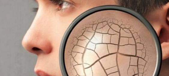 秋天嘴皮干燥起皮什么原因,秋天皮肤干燥起皮用什么护肤品