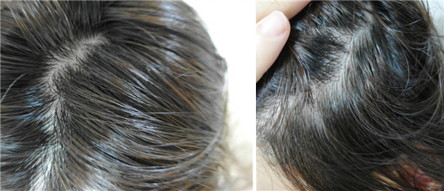 洗发水哪一款值得推荐,男士洗发水第一名