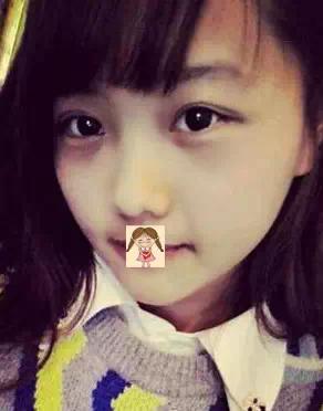 埋线双眼皮去掉线能恢复原样吗,纳米无痕双眼皮埋线怎么恢复得快