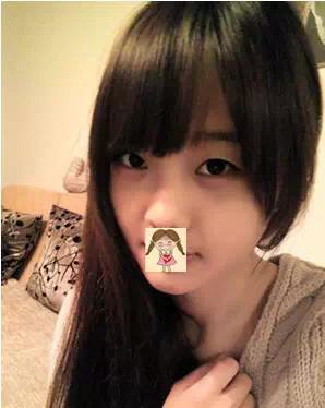 埋线双眼皮去掉线能恢复原样吗,纳米无痕双眼皮埋线怎么恢复得快