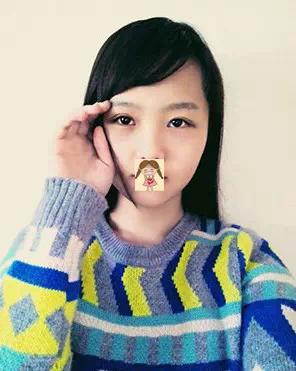 埋线双眼皮去掉线能恢复原样吗,纳米无痕双眼皮埋线怎么恢复得快