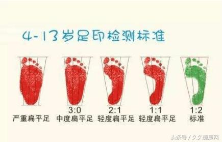 什么鞋会导致扁平足,青少年长期穿跑步鞋好吗