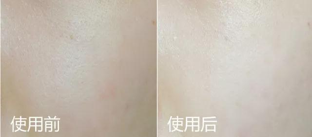 王丽坤范冰冰,王丽坤baby推荐面膜