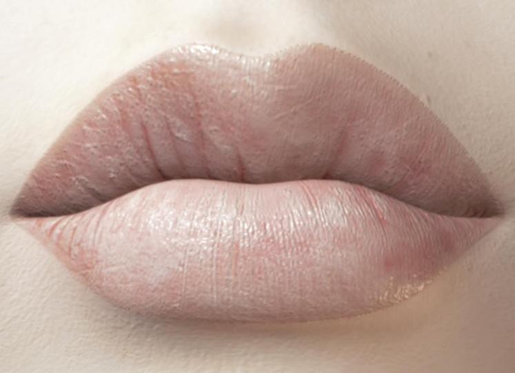 嘴唇发紫心脏有什么问题,嘴唇发紫一般是心脏哪里出了问题