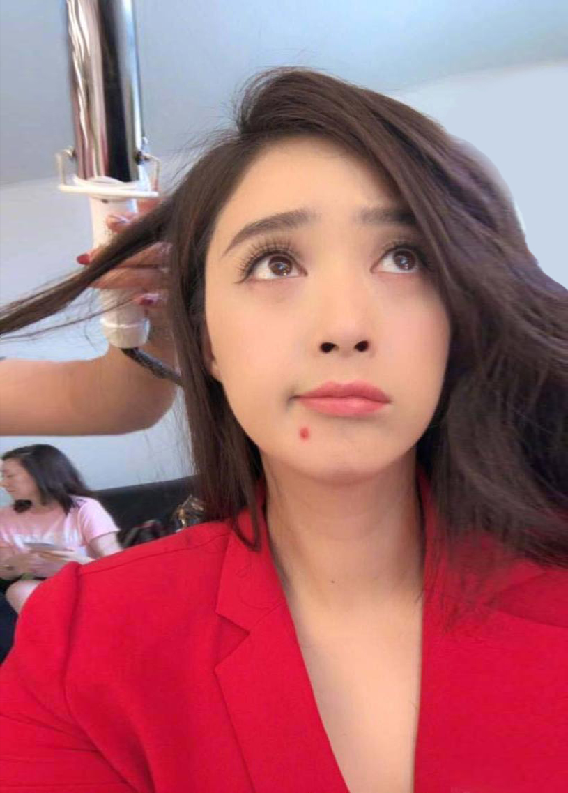 油痘皮的惨痛分享,痘坑血泪史