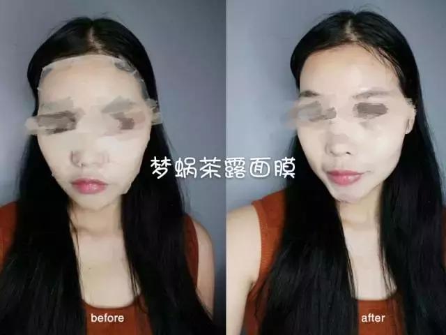 梦蜗面膜测评,wellderma梦蜗面膜真实测评