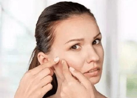 激素依赖性皮炎反复出疹子怎么办,激素依赖性皮炎抹薇诺娜起疹子