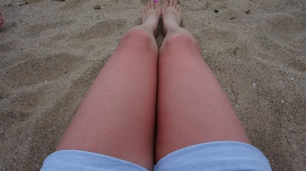 6个穿牛仔裤很重要的问题！上海一女孩穿牛仔裤就得过皮炎