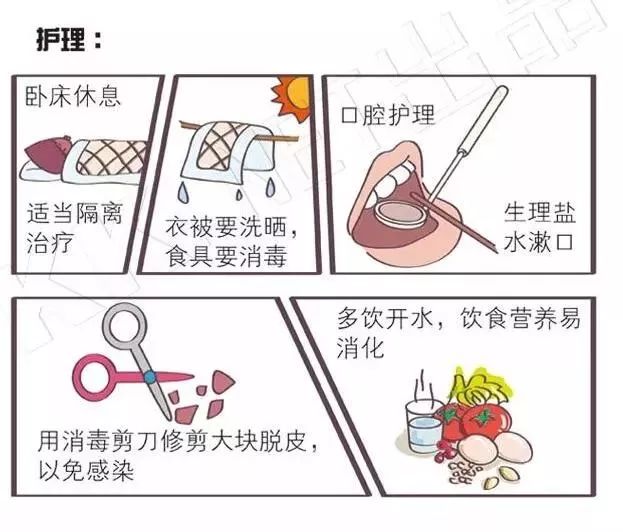 猩红热最新疫情报告发布,猩红热儿童预防