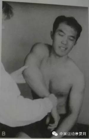 肩峰撞击综合征肩袖损伤怎么治疗,肩峰下撞击综合征导致肩袖损伤