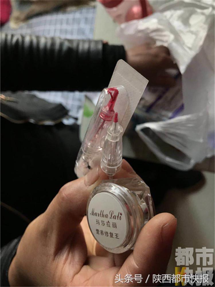 女子千元漂唇肿胀五天如“香肠”