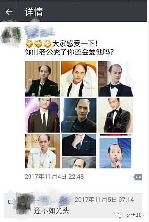 发际线后移男怎么拯救,18岁发际线后移怎么补救男