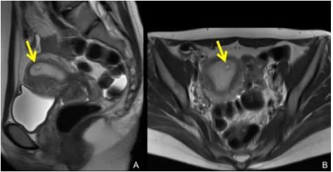 哪些女星是剖腹产,哪些女星是剖腹产的