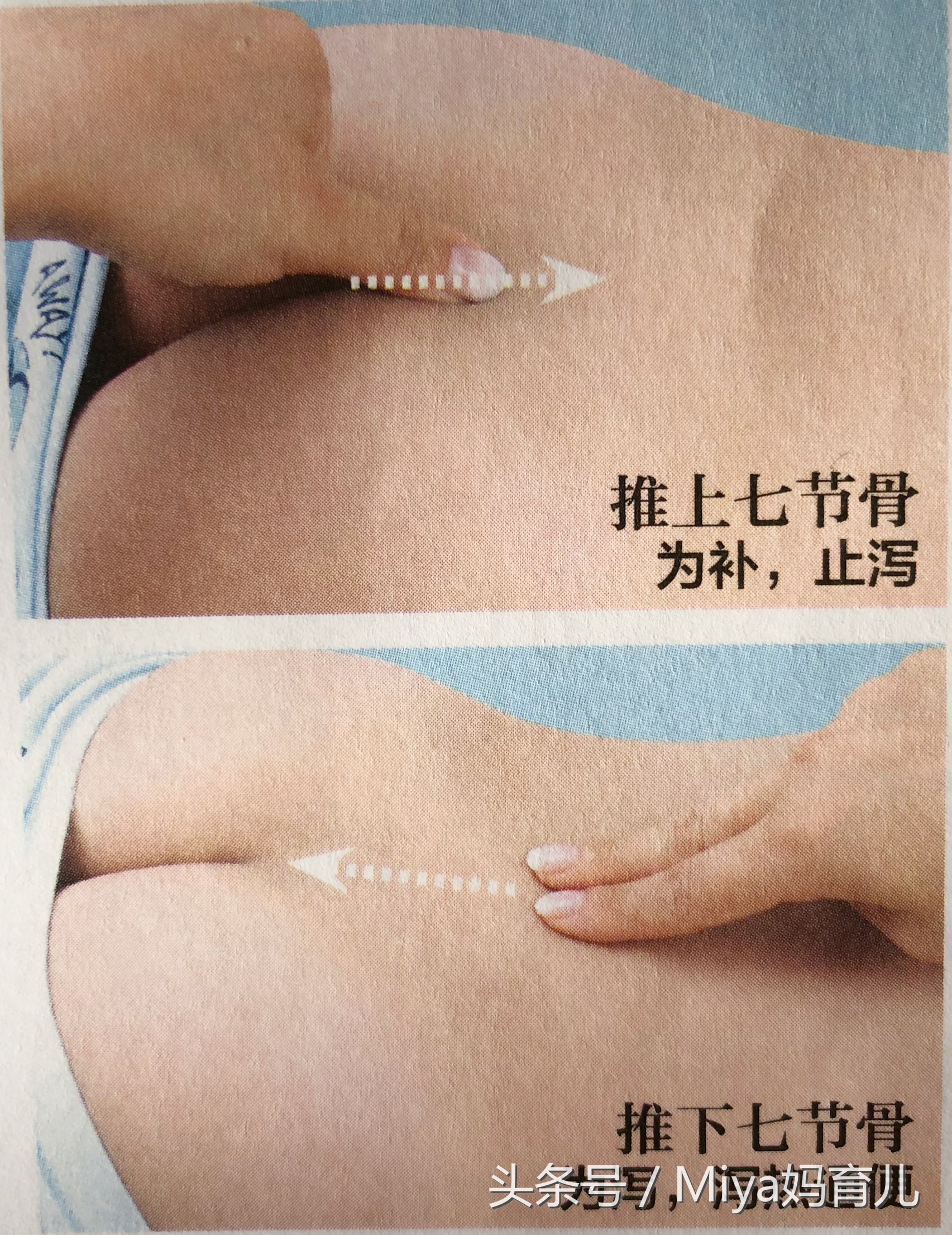 小儿推拿湿疹的调理,小儿推拿湿疹的正确手法视频