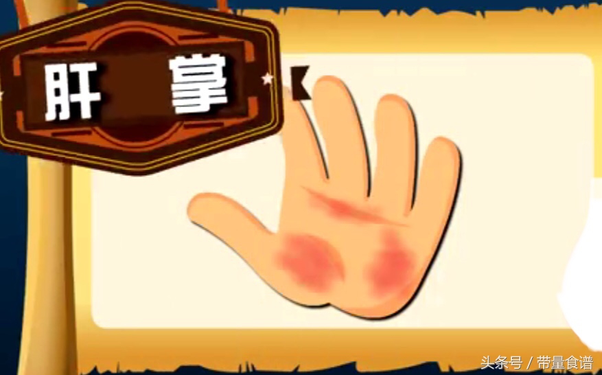 大三阳小三阳报告单对照图片,得乙肝是先得大三阳还是小三阳