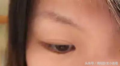 南阳时光整形美容,南阳提眉整形