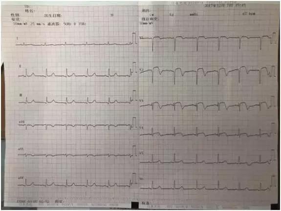 一天抢救两次,一天抢救两次还有救吗