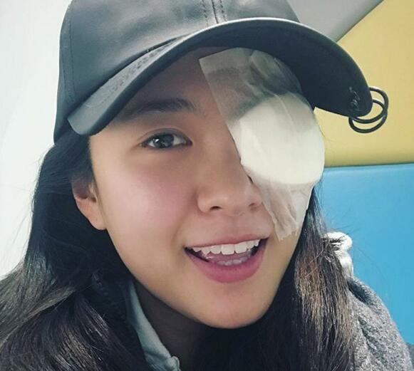 TVB美女小花生眼疮,变独眼龙但仍坚持开工,国产小鲜肉没得比!