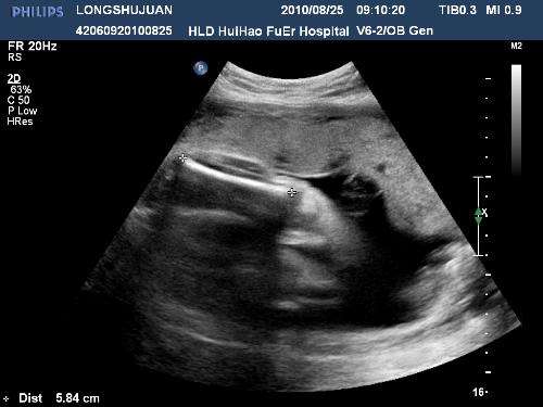 备孕2年检查遍了还怀不上咋办,备孕二年终于怀孕了