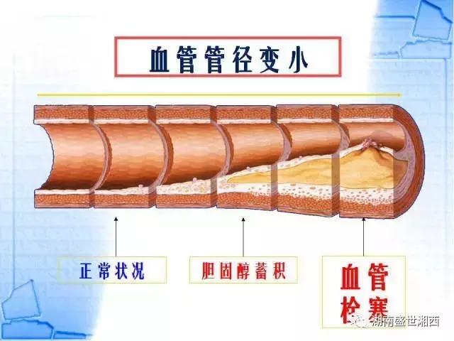 现代药理学表明杜仲具有三降「血压、血糖、血脂」、四抗、五护！