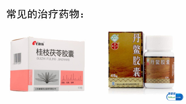 慢性盆腔炎的症状有哪些?常用的治疗药物有哪些?