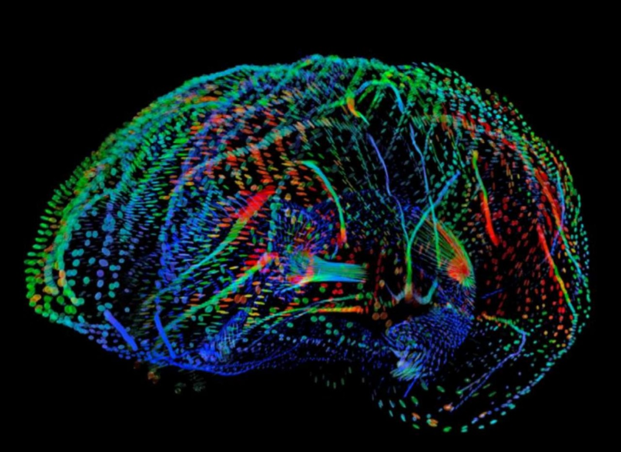 大脑皮层发育越晚智商越高吗,刺激大脑皮层可以提高智商吗