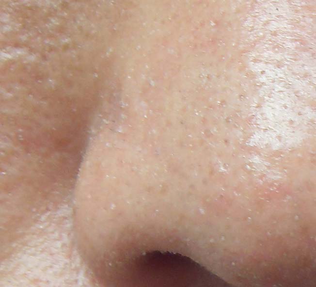 控油效果最好的洗发水,控油的方法