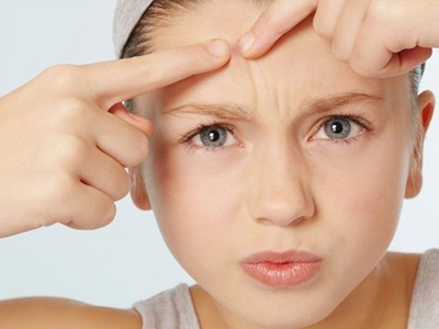 了解痘痘彻底告别青春痘,正确战痘第一步认清痘痘真面目