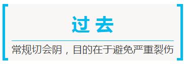 生孩子一定要外阴侧切吗,顺产要做阴侧切吗