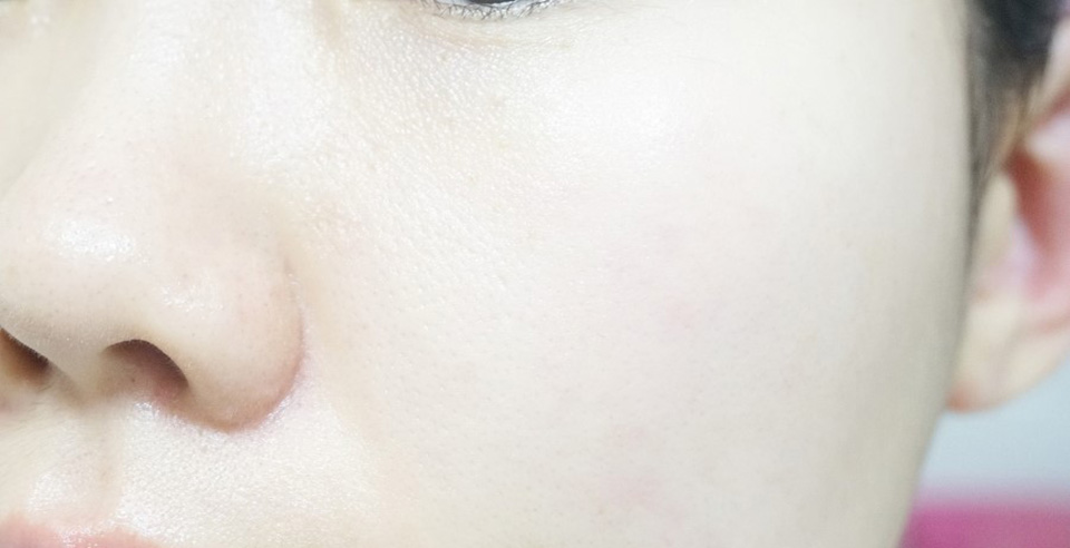 韩国露怡斯软玉祛痘面霜怎么样,韩国九朵云马油面霜的功效与作用