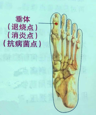 发烧引起的扁桃体发炎成人,儿童扁桃体发炎反复发烧怎么办