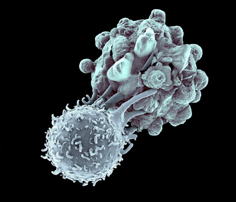 car-t治疗实体瘤进展,car-t治疗实体肿瘤成功案例