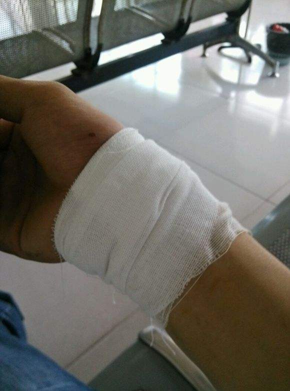 割腕轻生民警安慰,割腕轻生晕倒民警救援