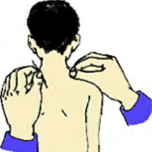 孩子发烧怎么办小儿推拿,孩子发烧怎么小儿推拿