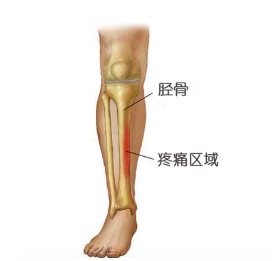 跑步有没有什么伤害,跑步如何减少身体的损伤