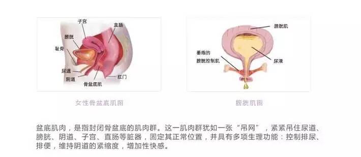 关爱女性健康，从盆底肌开始