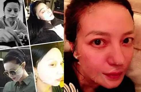 贴面膜导致黑斑,脸部黑斑面膜