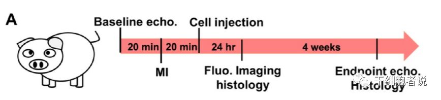 心肌梗死干细胞治疗,自身骨髓干细胞移植治疗心肌梗死