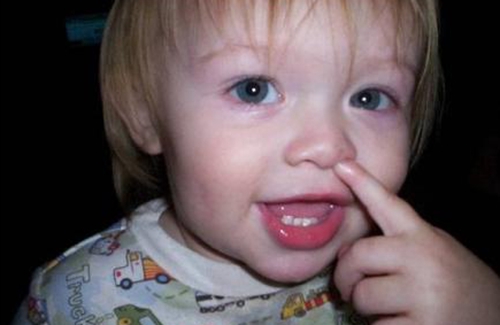 冬天干燥宝宝鼻屎堵住,冬季宝宝鼻子里有鼻屎干燥怎么办