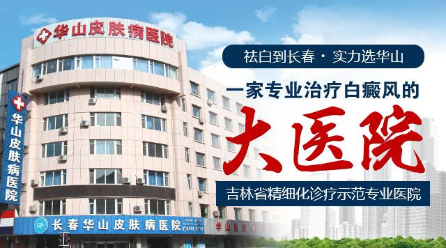 手部白癜风难恢复记住这点好得快,白癜风怎么治好得快