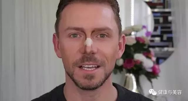 杨幂、唐嫣、神仙姐姐的鼻子原来是这样“整的”！