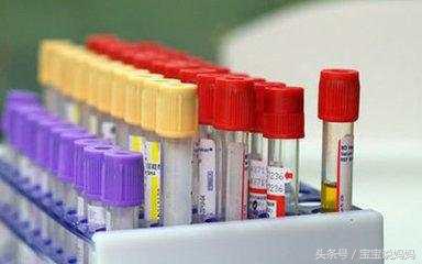 孕妇尿液蛋白质偏高怎么回事,孕妇尿液蛋白质10.3