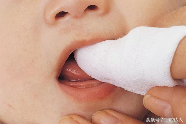 婴儿开始长乳牙该如何护理口腔,宝宝长恒牙怎么护理