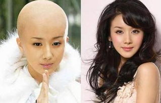 女明星没了刘海变好看了,女明星突然没头发了
