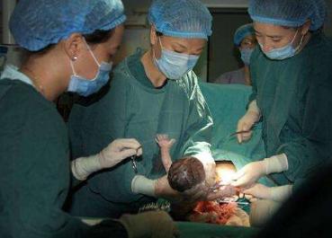 剖腹产一年半突然检查出怀孕了,剖腹产1年后意外怀孕