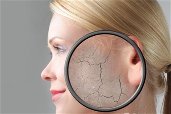 皮肤过敏严重缺水怎么解决,脸过敏紧绷干燥缺水怎么办