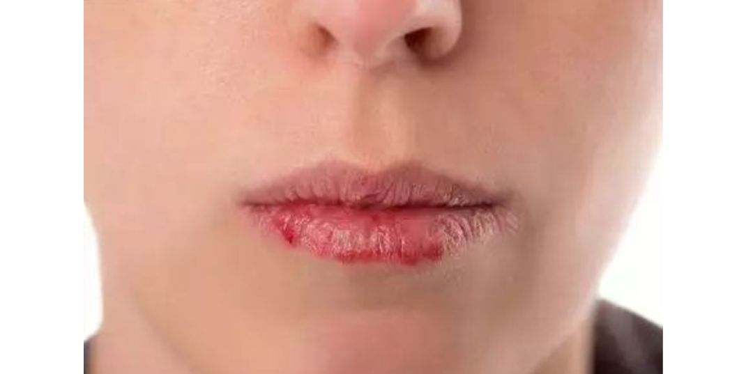 公认好用的润唇膏,口碑最好的润唇膏第一名