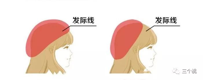 脸大贝雷帽戴法,脸大头发特别少贝雷帽戴法